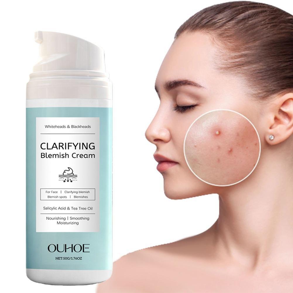 Salicylic Acid Blackhead Remover - Salicylic Acid Acne Removing Cream Nourishing